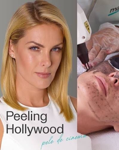 Hollywood Peel na Maislaser Taboão