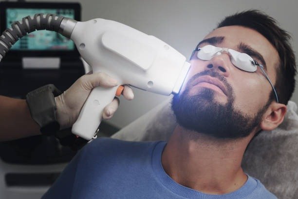 Depilação a Laser — Barba Completa na Maislaser Taboão